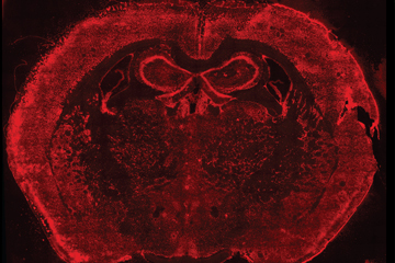 To develop fluorescent in situ sequencing, scientists first fix in place thousands of RNAs -- including working copies of genes called messenger RNAs -- in cells, tissues, organs or embryos. Here, RNAs are labeled red in a mouse brain. Image: HMS and Wyss.