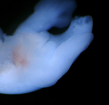 Lizard (Anolis) embryonic hemipenis, a stage 9 lizard embryo, showing the two hemipenes buds in the center of the image, at the same level as the developing hind limbs. Image: Patrick Tschopp