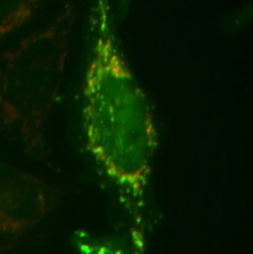PARKIN (green) is localized on damaged mitochondria. Image: Harper Lab