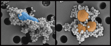 This image demonstrates the effectiveness of the genetically engineered protein-coated magnetic beads binding to pathogens. Here, the magnetic beads (128 nm) are bound to two pathogens (E. coli on the left and S. aureus on the right). Image: Harvard’s Wyss Institute