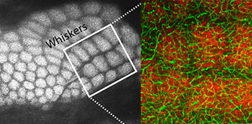 Mouse barrel cortex (left) showing axons in red and brain vessels in green (right). Image: Baptiste Lacoste