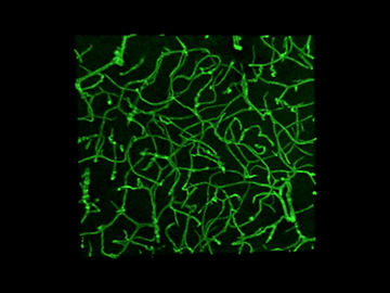 Three-dimensional imaging uncovered vascular changes that may have been missed in two-dimensional studies. Video: Baptiste Lacoste