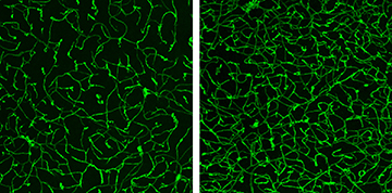 Blood vessel networks in mouse brains were less complex after sensory deprivation (left) and more complex after sensory stimulation (right), suggesting that sensory-related neural activity affects blood vessel structure. Image: Baptiste Lacoste