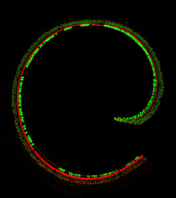 Sensory hair cells in the cochlea of a Beethoven mouse treated with TMC2 gene therapy. In this confocal microscopy image, microvilli are shown in red and cell bodies in green. The human ear has about 16,000 sensory hair cells. Image: Charles Askew 