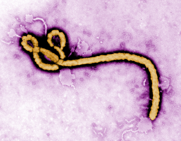 Colorized micrograph of an Ebola virus virion.Image: CDC
