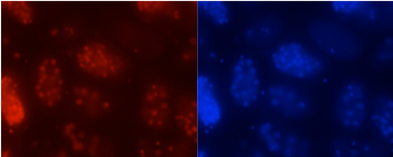 Immunofluorescence shows C. elegans eggs: DNA in blue and a previously unreported DNA modification where adenines are methylated in red. Image: David Aristizábal-Corrales