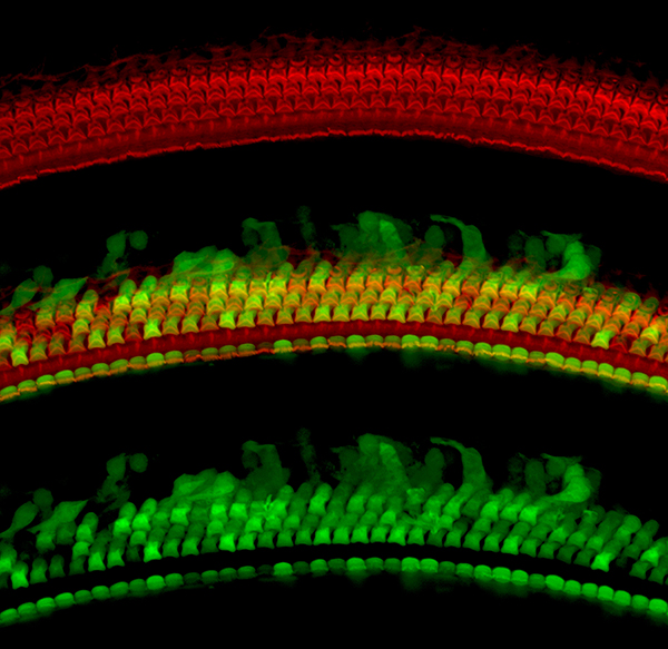 Top: Red stain shows mouse hair cells alone. Middle: Hair cells take up the vector, which carries a gene for green fluorescent protein. Bottom: All cells that took up the vector are shown in green. Image: Charlie Askew and Jeffrey Holt