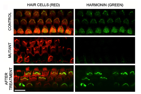 Top row: Healthy control mice have normal hair cells, stained red, that produce full-length harmonin protein, stained green. Middle row: Mice with Ush1c mutations have disorganized hair cells that lack harmonin. Bottom row: After therapy delivering a healthy Ush1c gene, hair cells again produce full-length harmonin. Image: Gwenaëlle Géléoc