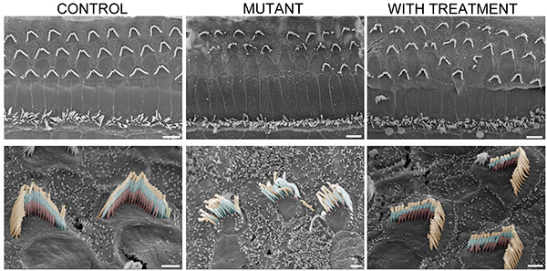 Unaffected mice, at left, have sensory hair bundles organized in “V” formations with three rows of cilia (bottom left). This orderly structure falls apart in the mutant mice (middle column) but is restored after gene therapy treatment (right). Image: Gwenaëlle Géléoc and Artur Indzhykulian