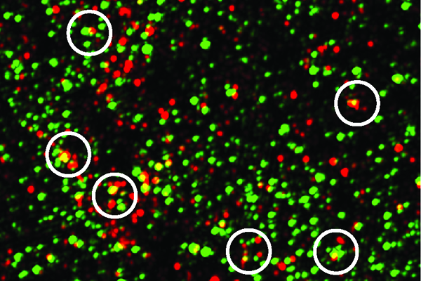 The complement protein C1q, shown in green, tags synapses, indicated by the postsynaptic protein PSD95, shown in red. The yellow dots show C1q and PSD95 overlapping. Mice with Alzheimer’s-like disease had more synapses tagged with C1q than their disease-free siblings. Image: Soyon Hong
