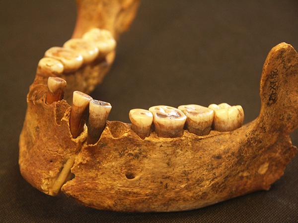 This lower jaw belonged to an approximately 19,000-year-old woman called the "Red Lady of El Miron Cave" in northern Spain. She was the first individual in the study to show a resurgence in ancestry from a population that appeared to have died out for 15,000 years. Image copyright Lawrence G. Straus