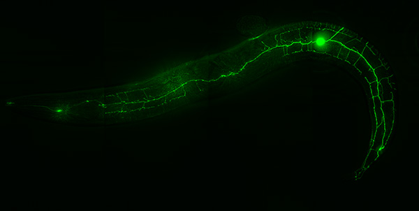 Destroying the extra neurons revealed that they had been signaling one another to stay in their own areas. Image: Candice Yip