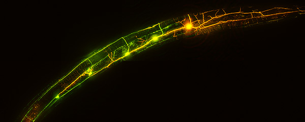 Without netrin, dendrites from the five neurons overlap. Image: Candice Yip