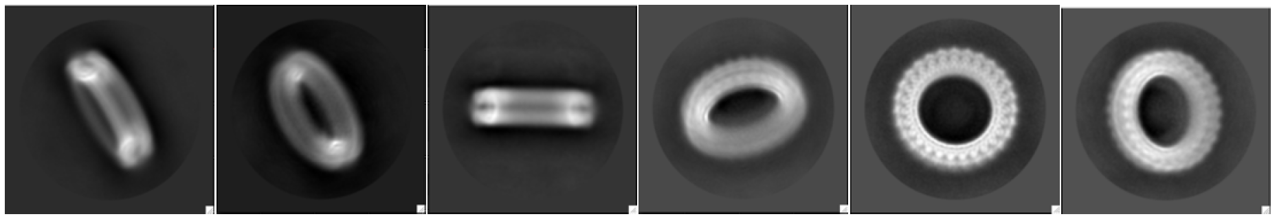 Cryo-EM technology captured elegant details of the gasdermin pore. Images: Wu lab