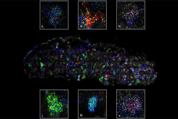 The confetti technique reveals germinal center activity in the spleen. Each color represents a specific B-cell antibody clone. The B cells battle within germinal centers to produce the most effective antibody for a given antigen. Image: Carroll lab