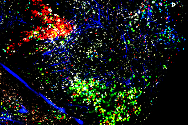 Neighboring germinal centers of the spleen in a mouse model of lupus: “Red” and “green” B cells emerge as producers of the best autoantibodies. Image: Carroll lab