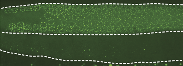 WAGO-4, shown in green, concentrates in germline cells, top, and not in somatic cells, or ordinary body cells, bottom. Image: Kennedy lab