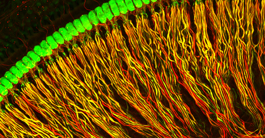 Spiral ganglion neurons