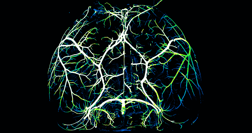 Arteries in a mouse brain.