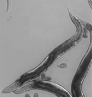 Black and white micrograph of long worms with round eggs