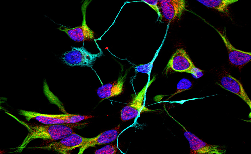 Neurons in blue and turquoise stand out against neurons in pink and green
