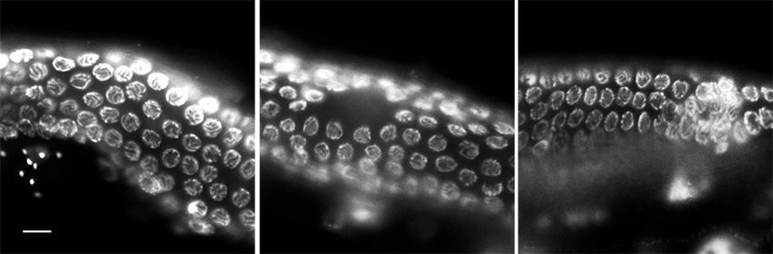 three microscopic views of worm eggs