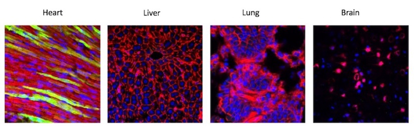 Four microscope squares showing heart, liver, lung and brain tissue