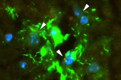 Cluster of bright green cells with a few red dots scattered throughout