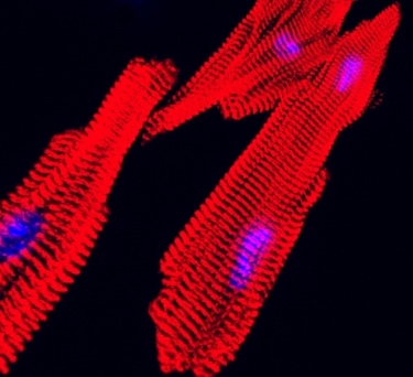 Microscopy image of red striated heart muscle fibers with blue nuclei