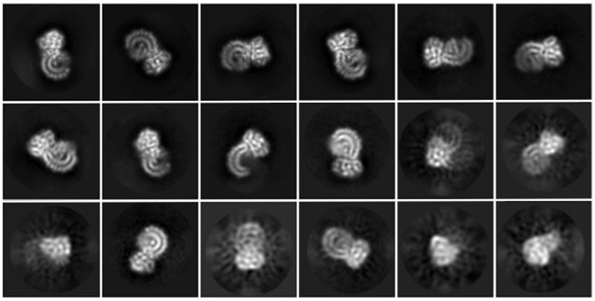 18 square microscopy images of curly protein in different orientations