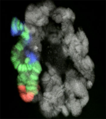 Oligopaints show a multicolor banding pattern in chromosomes. The method allows higher resolution at a lower price. Image courtesy of Brian Beliveau, Eric Joyce and Nicholas Apostolopoulos.