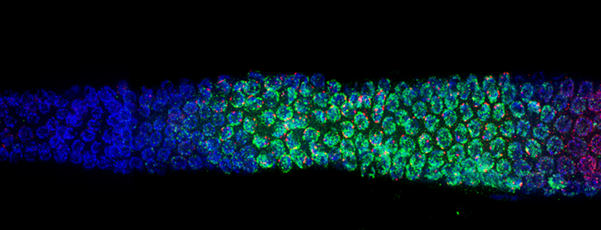 microscope image of C. elegans cells in different fluorescent colors