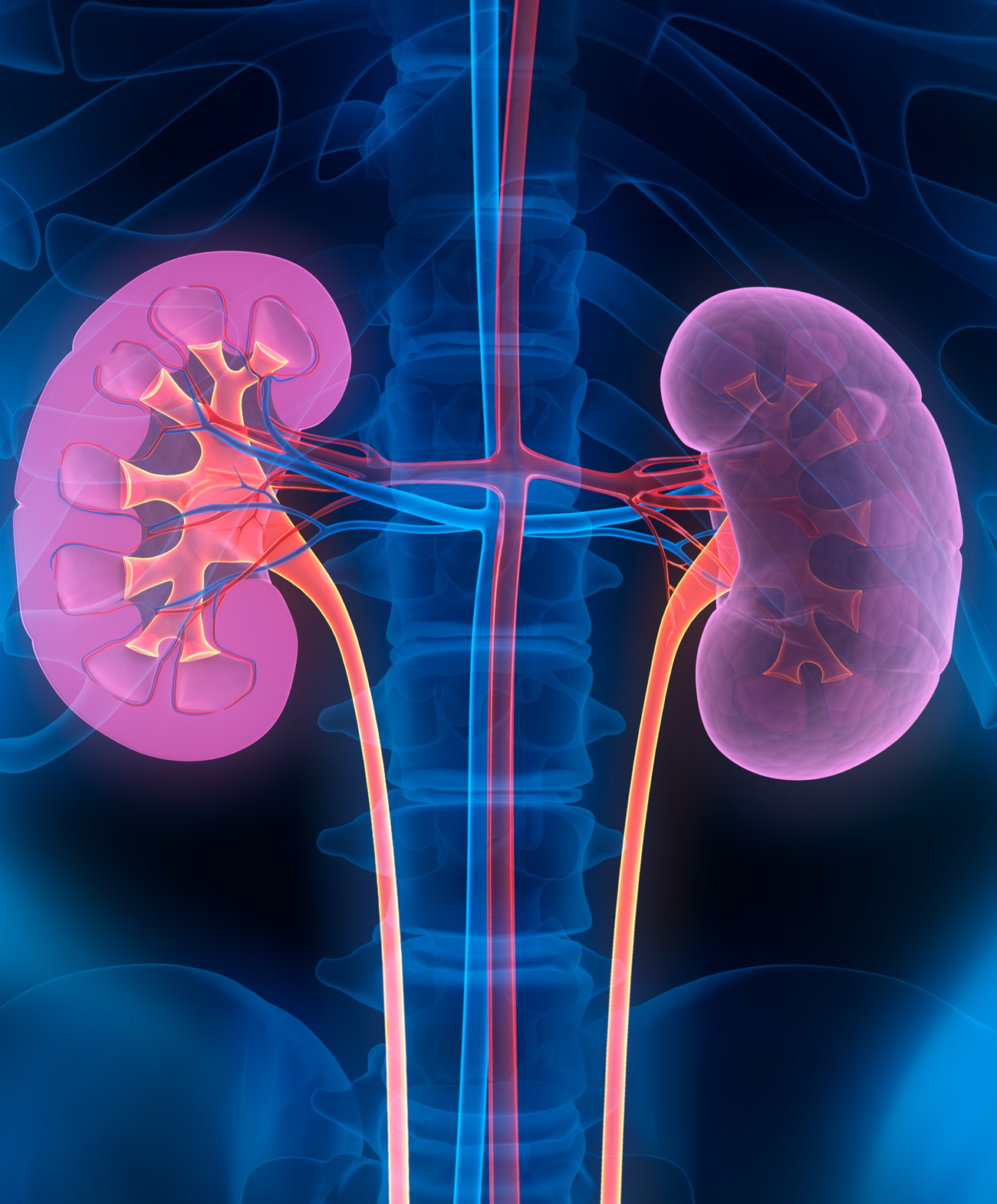 colorized x-ray-like image of the kidneys