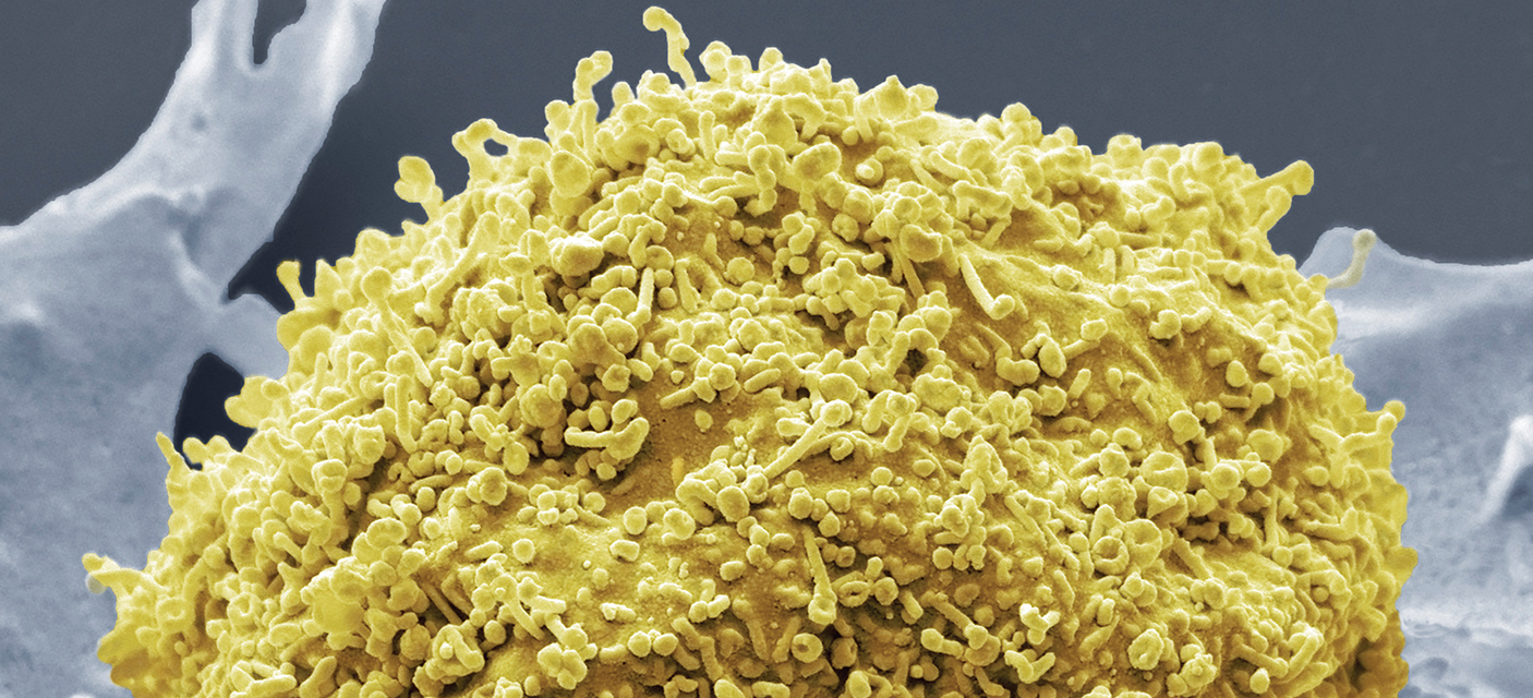 micrograph of cultured T cells with exosomes budding on surface