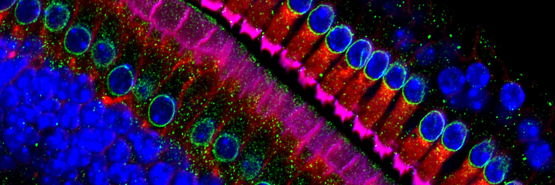 colorized micrograph of hair cells within an ear