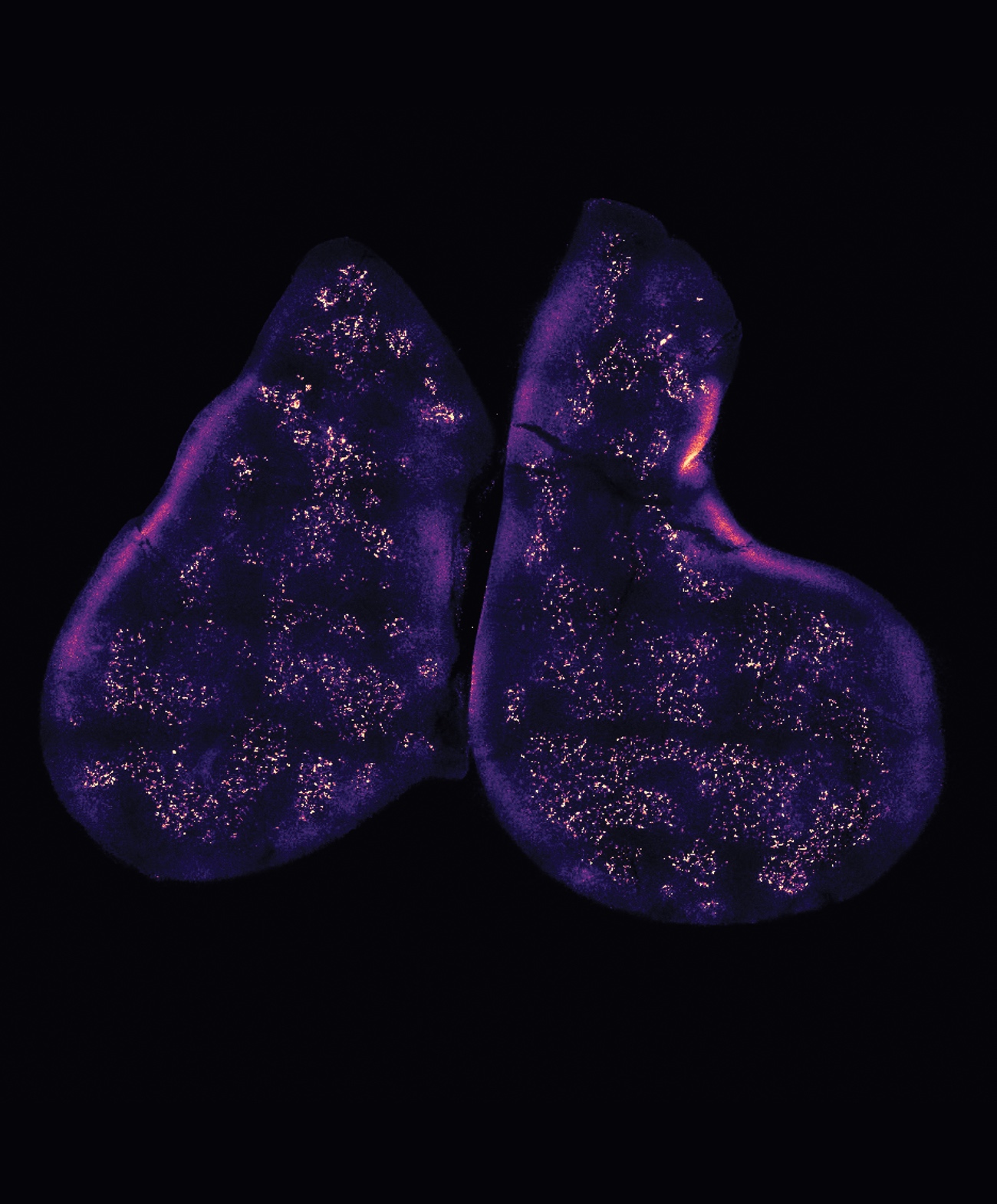 Immunology, CAR T Cells, and Gut Bacteria Harvard Medicine magazine