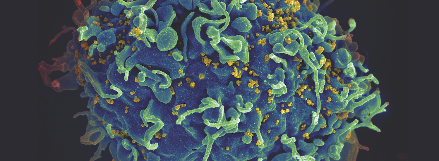 HIV