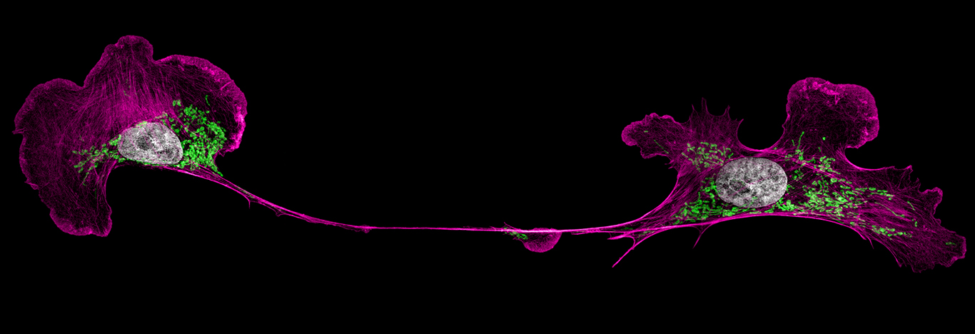 New resource helps researchers select fluorescent proteins for experiments