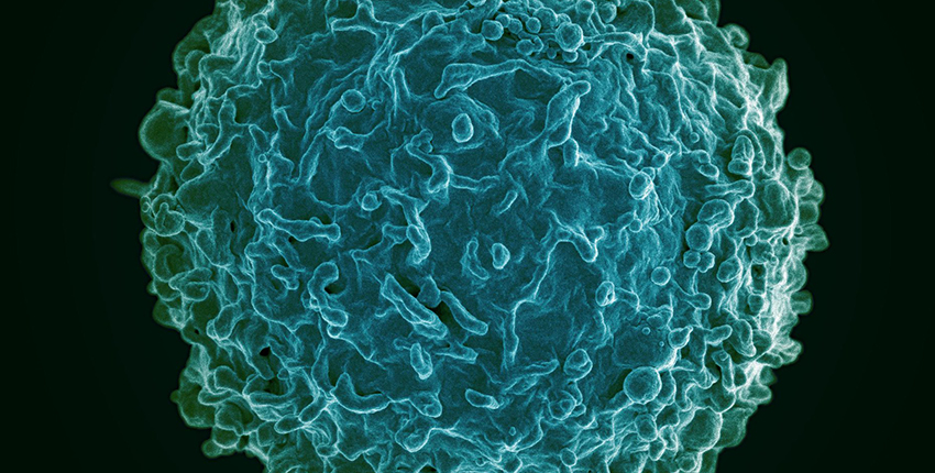Magnified image of a spherical cell with many protrusions on its surface, colored blue-green