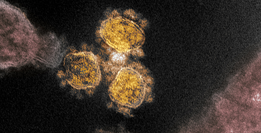 Colorized micrograph of three SARS-CoV-2 viral particles against a dark background