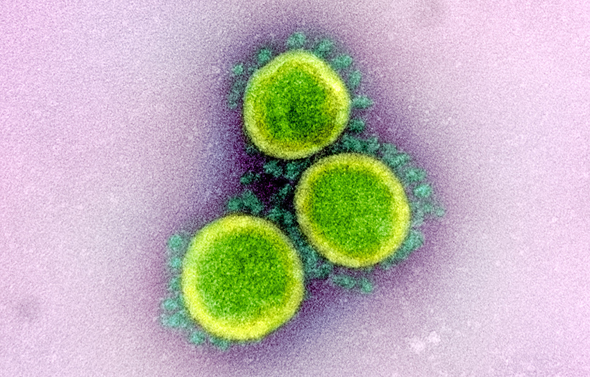 Three virus particles artificially colored green against a pink background
