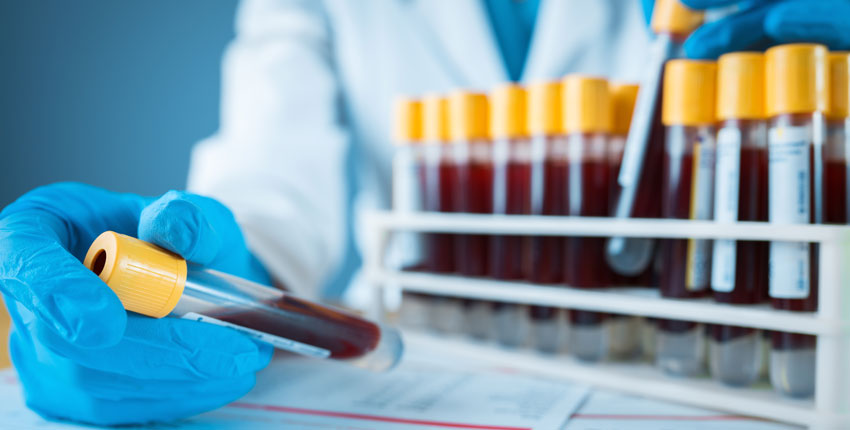 Image of blue-gloved hand holding a test tube full of blood 