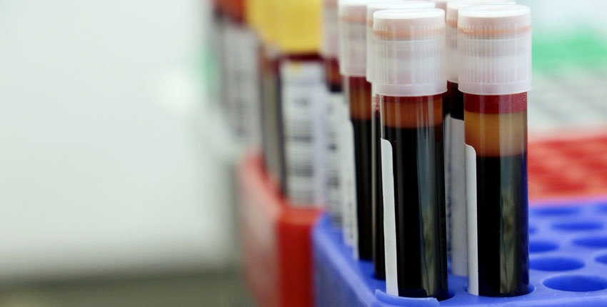 Test tube vials filled with red liquid 