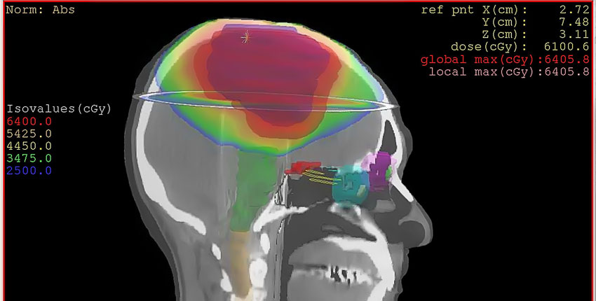 MRI-type image of brain scan, profile view 