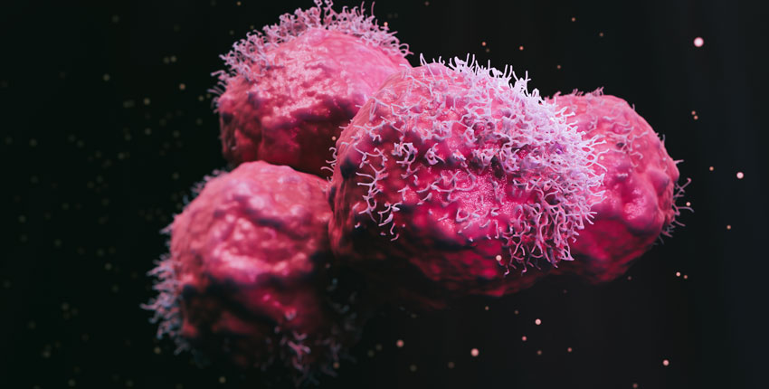 Illustration of malignant cancer cells 