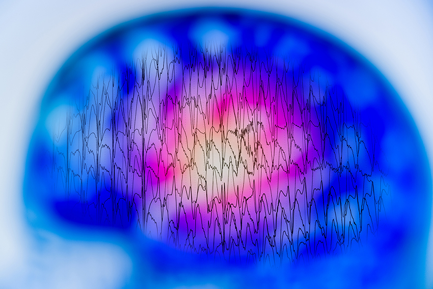 brain eeg