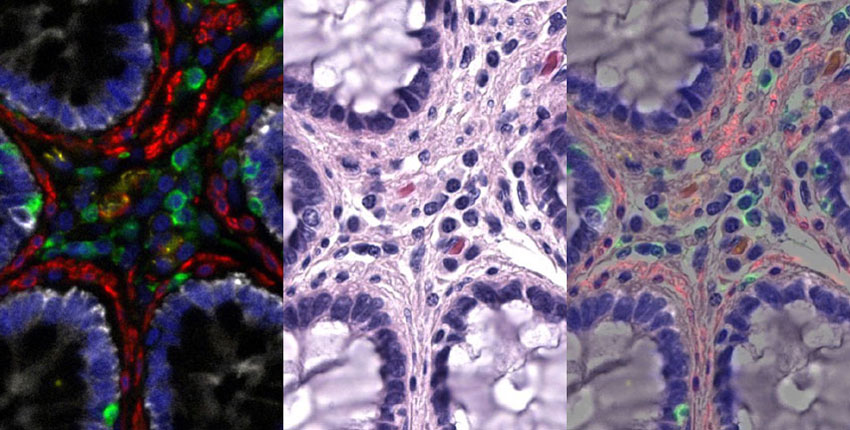 Three side-by-side images of the same starlike arrangement of cells, each in different colors