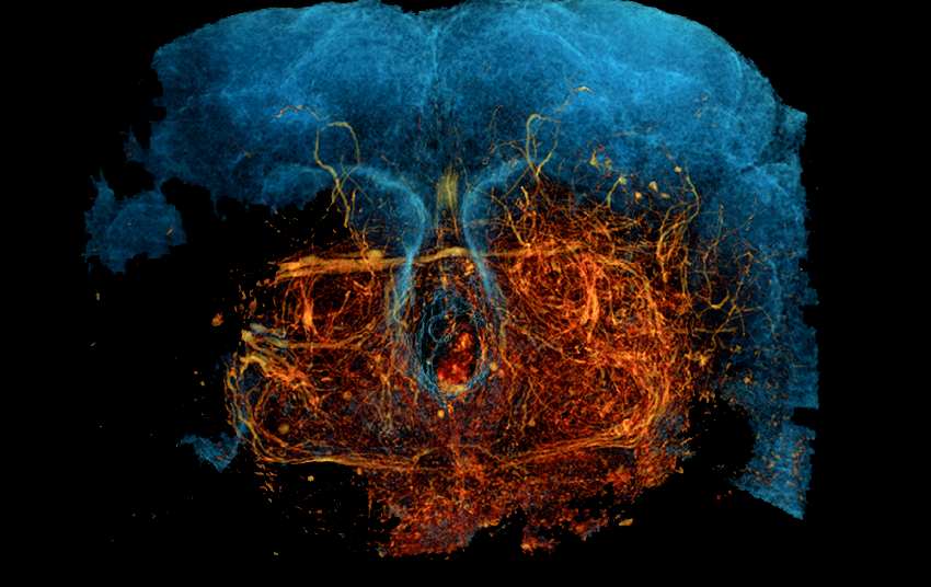 Fruit fly's complete brain wiring map offers insights into human