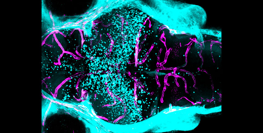 A blue, pink, and black image of a zebrafish brain