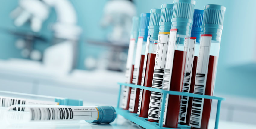 A rack of tubes containing blood samples, with two empty tubes lying down